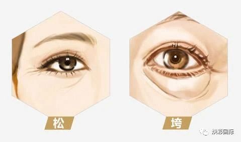 年龄是女人的秘密,但是皱纹会出卖你!(图4) 年龄是女人的秘密,但是皱纹会出卖你!(图4)